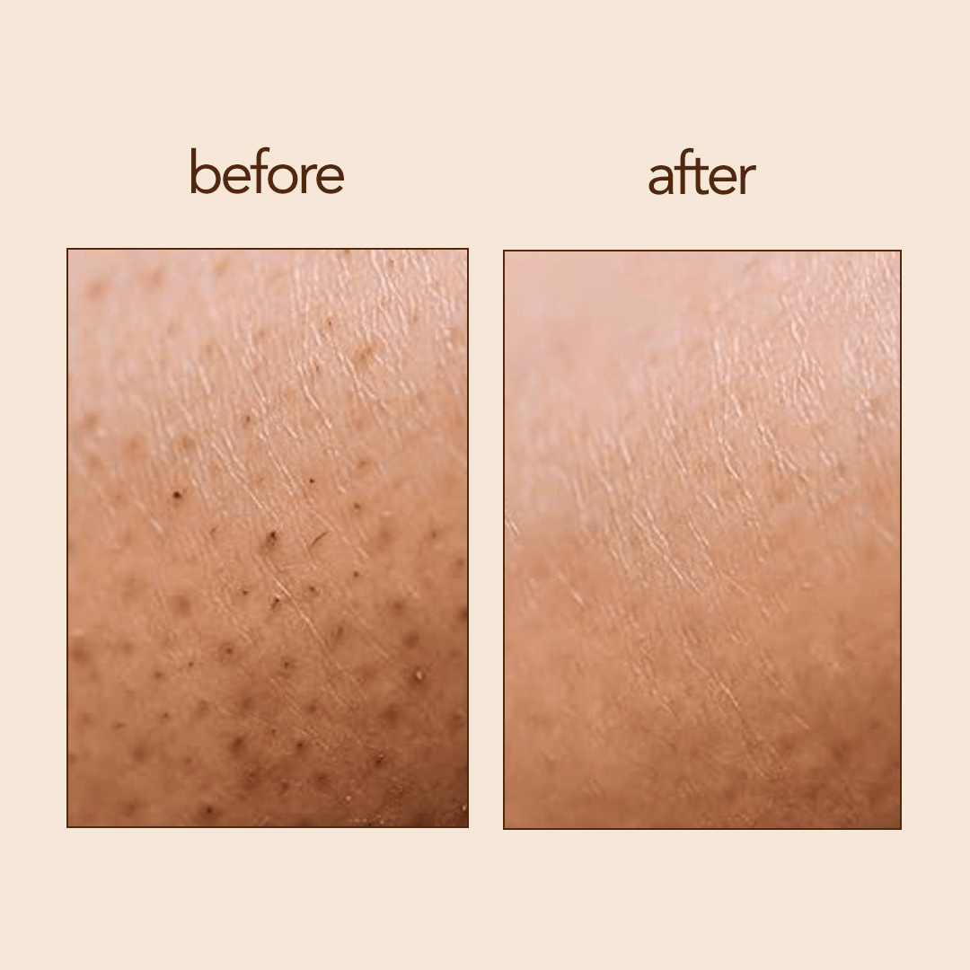 best dry brush for improving circulation